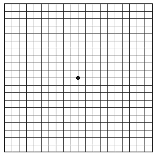 Amsler grid of black lines forming small squares and black dot in the center.