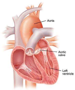 Four-chamber view of heart showing aortic valve.