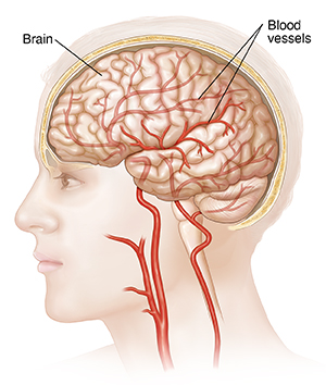 Side view of head, brain, and blood vessels to the brain.